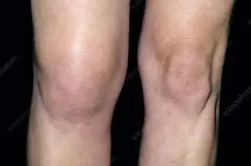 close up of a knee