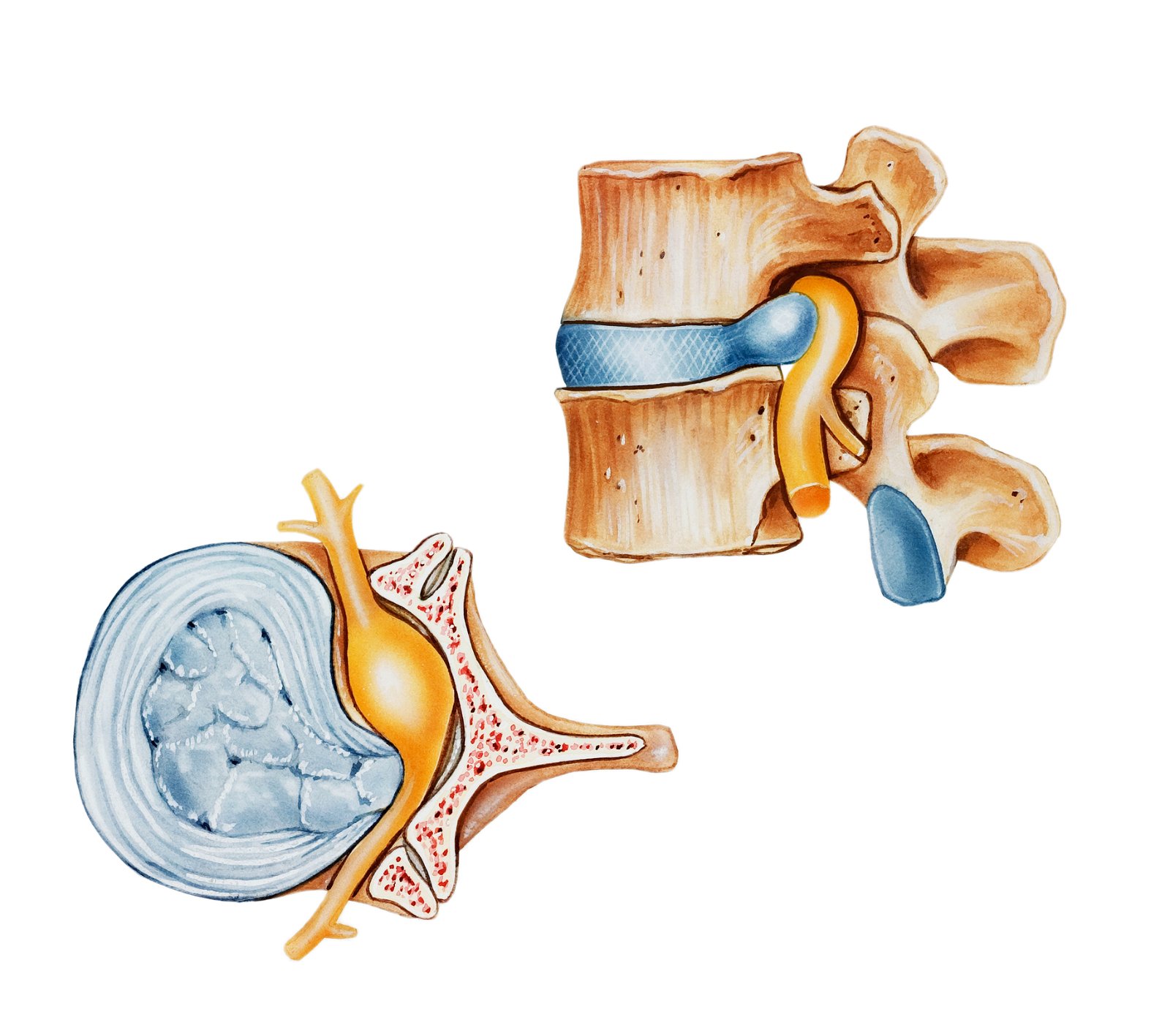 hernija diska anatomija