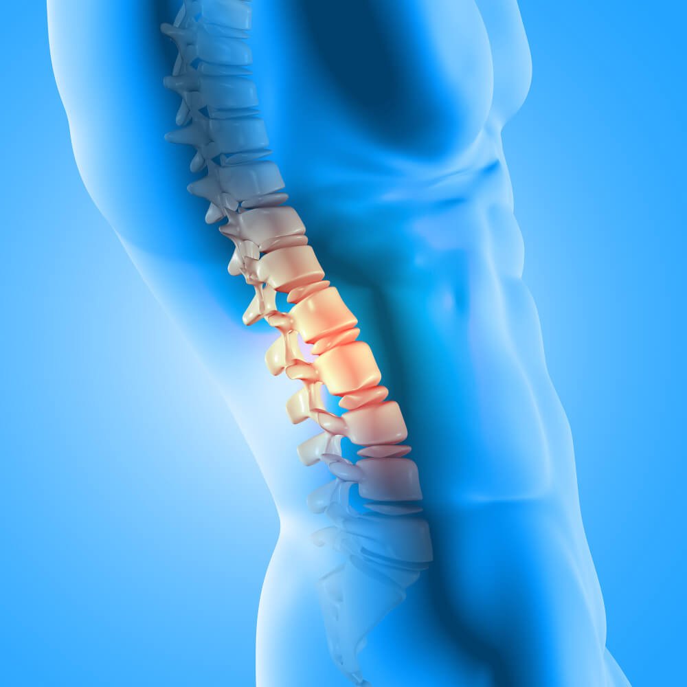 spondiloza hrbtenice vzroki