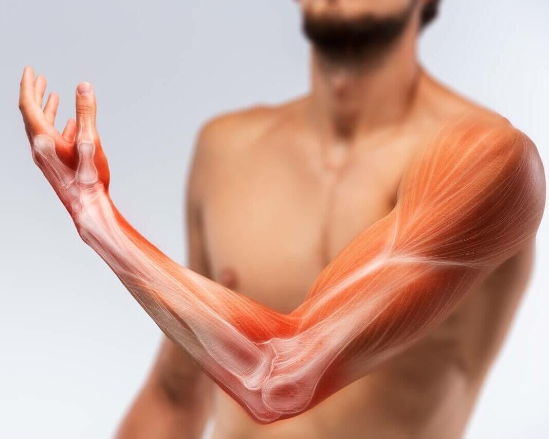 MUSCLES AND TENDONS