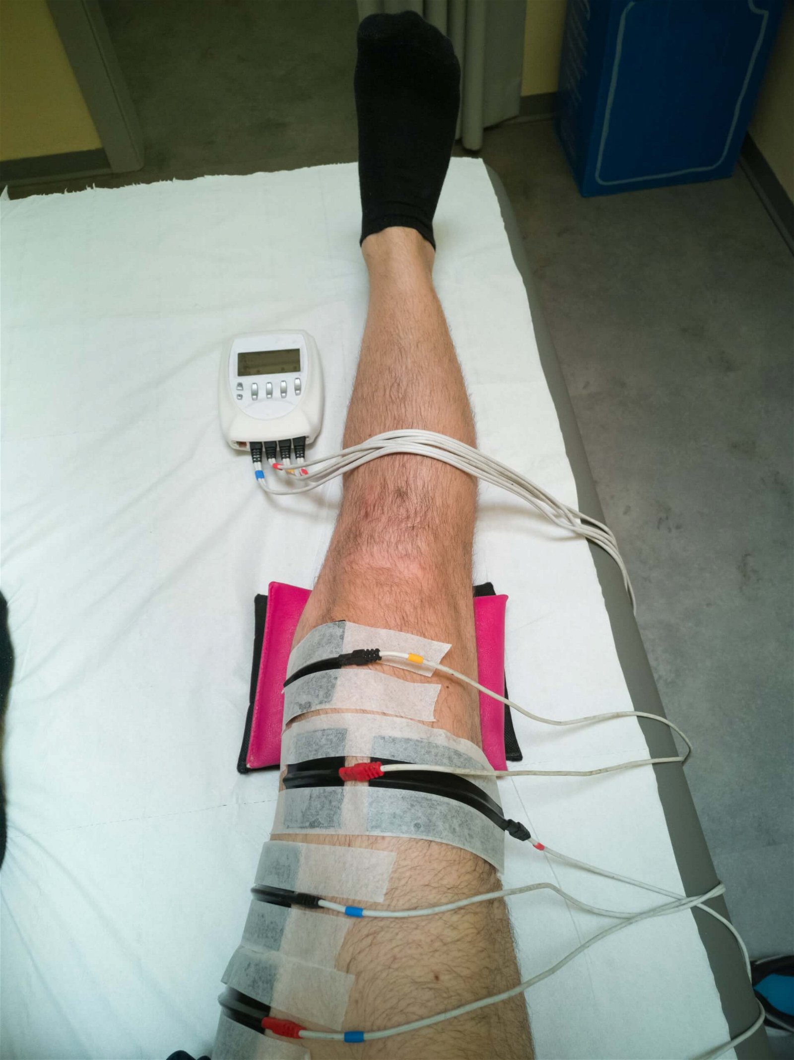Medicofit-physiotherapy-reconstruction-ACL