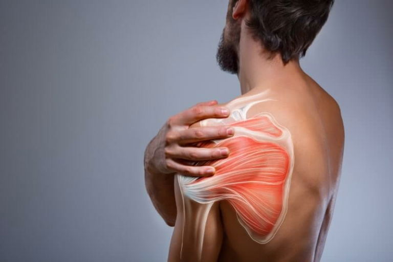 Calcification of the shoulder – What is it and how do we get rid of it?