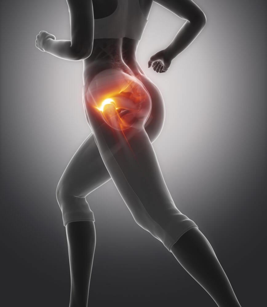 hip pain illustration