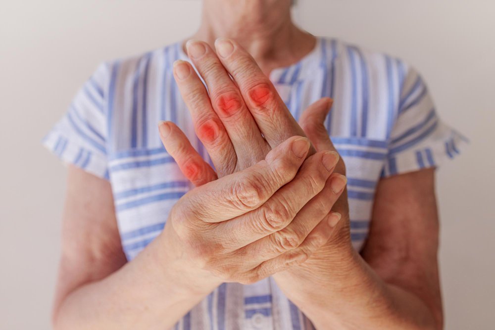 Artritis – vzroki, simptomi in zdravljenje