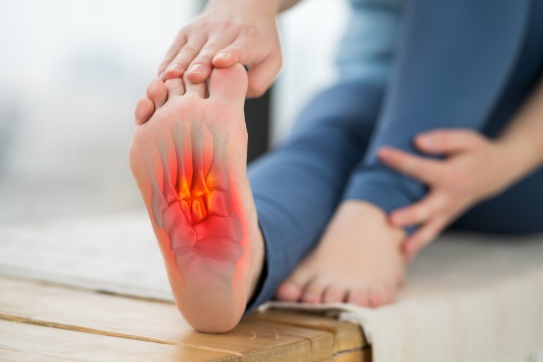 Vaje za plantarni fasciitis: 5 učinkovitih vaj